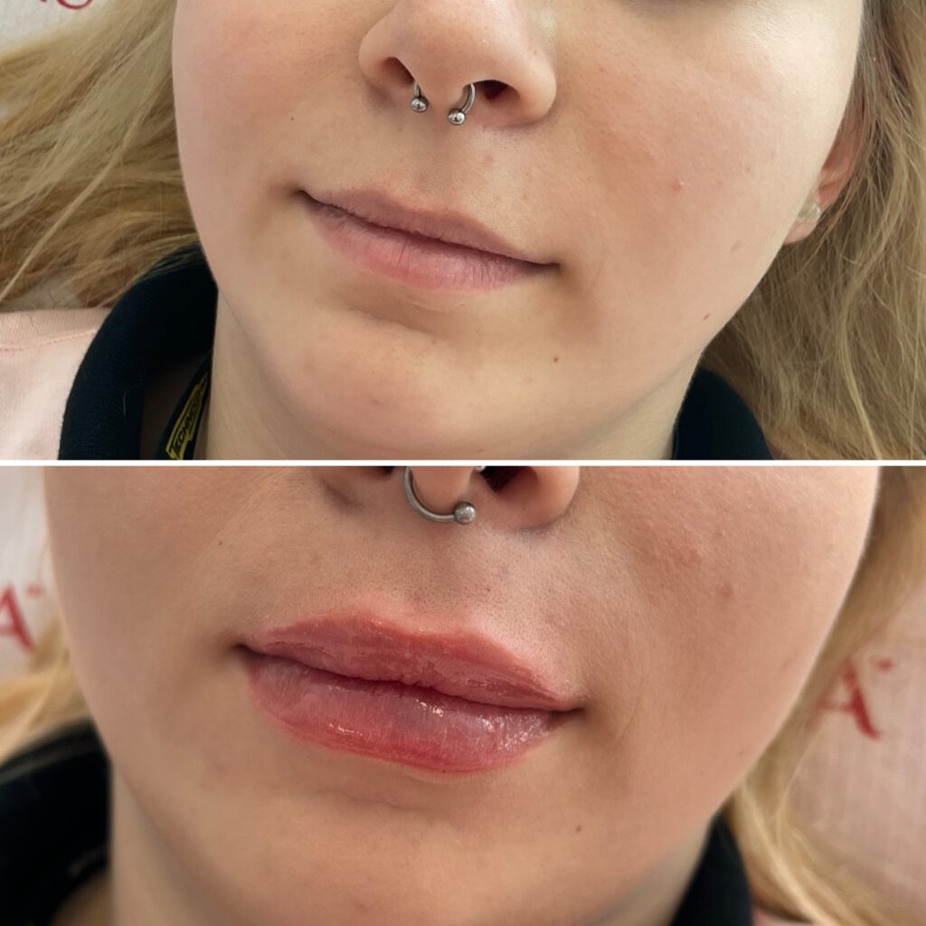 Home - Face Flow Clinic - Klinika Wawer
